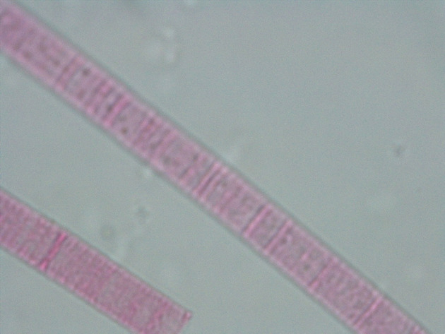 Oscillatoria Slides - Oscillatoria 01 200X